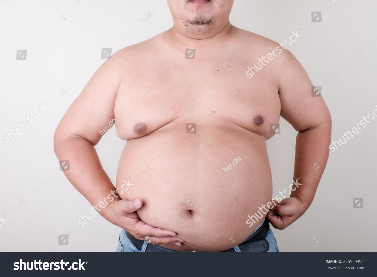 Fat Man With A Big Belly. Diet. Stock Photo 125676164 