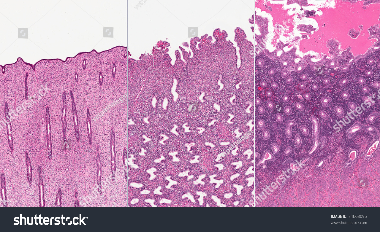 Layers Of Endometrium Histology