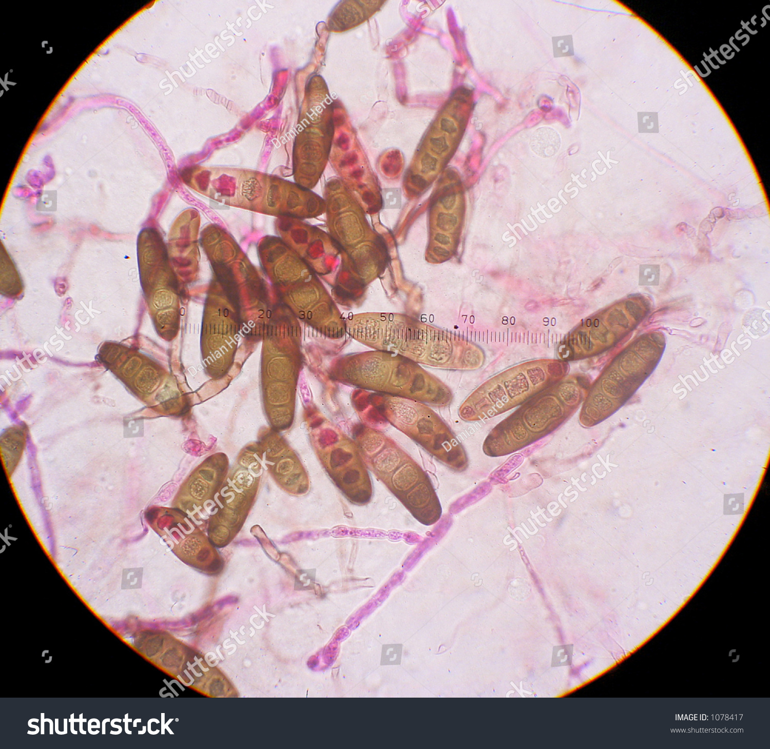 Fungal Spores Under The Microscope Fungus Causes A Plant Disease 