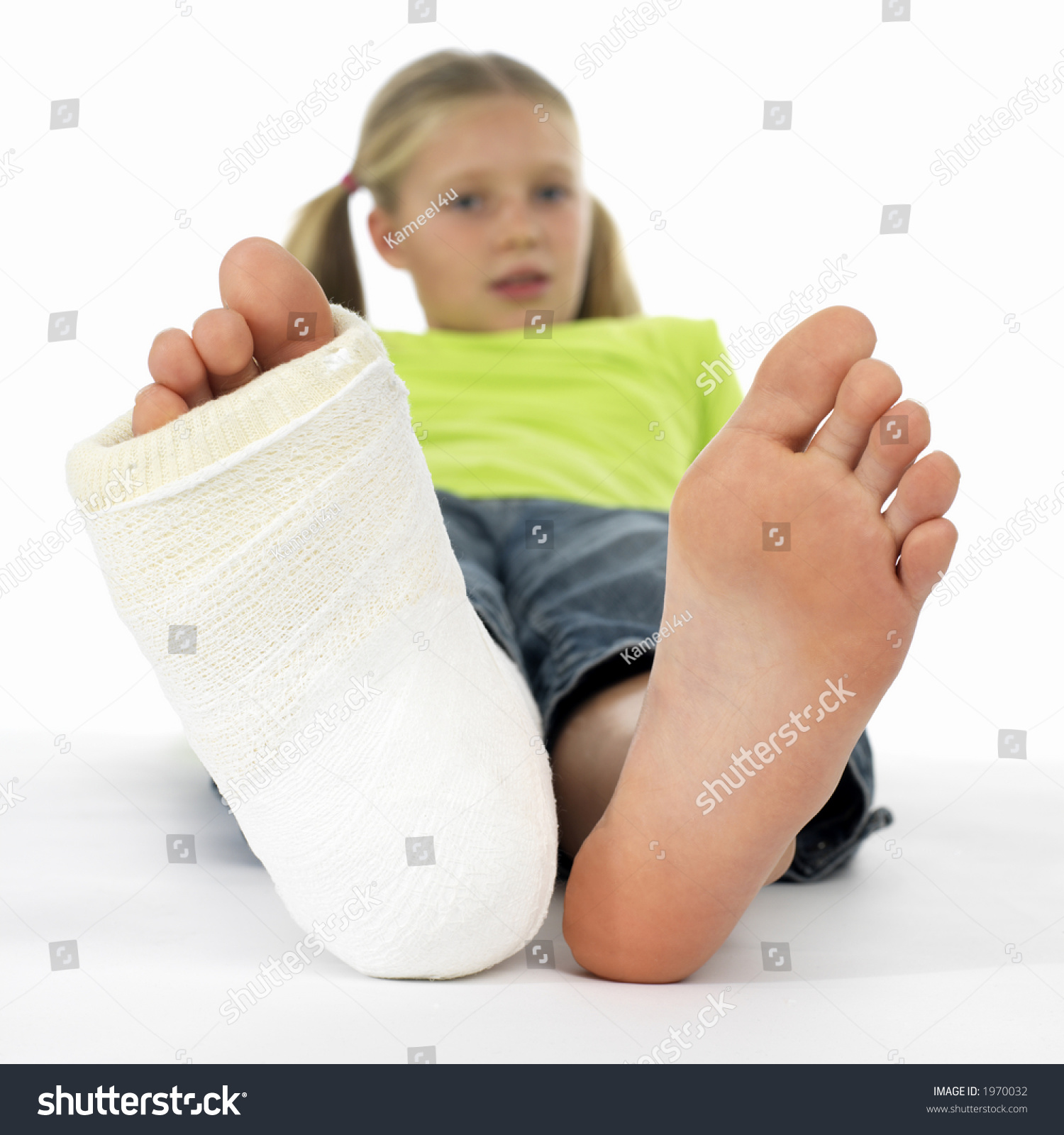 Girl Broken Leg Closeup Feet One Stock Photo 1970032
