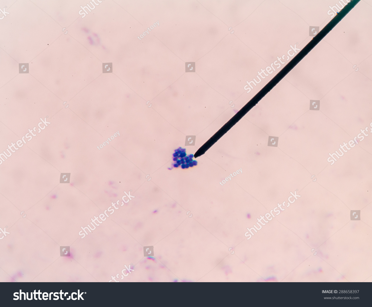 Gram Positive Cocci Find Microscope Stock Photo Shutterstock