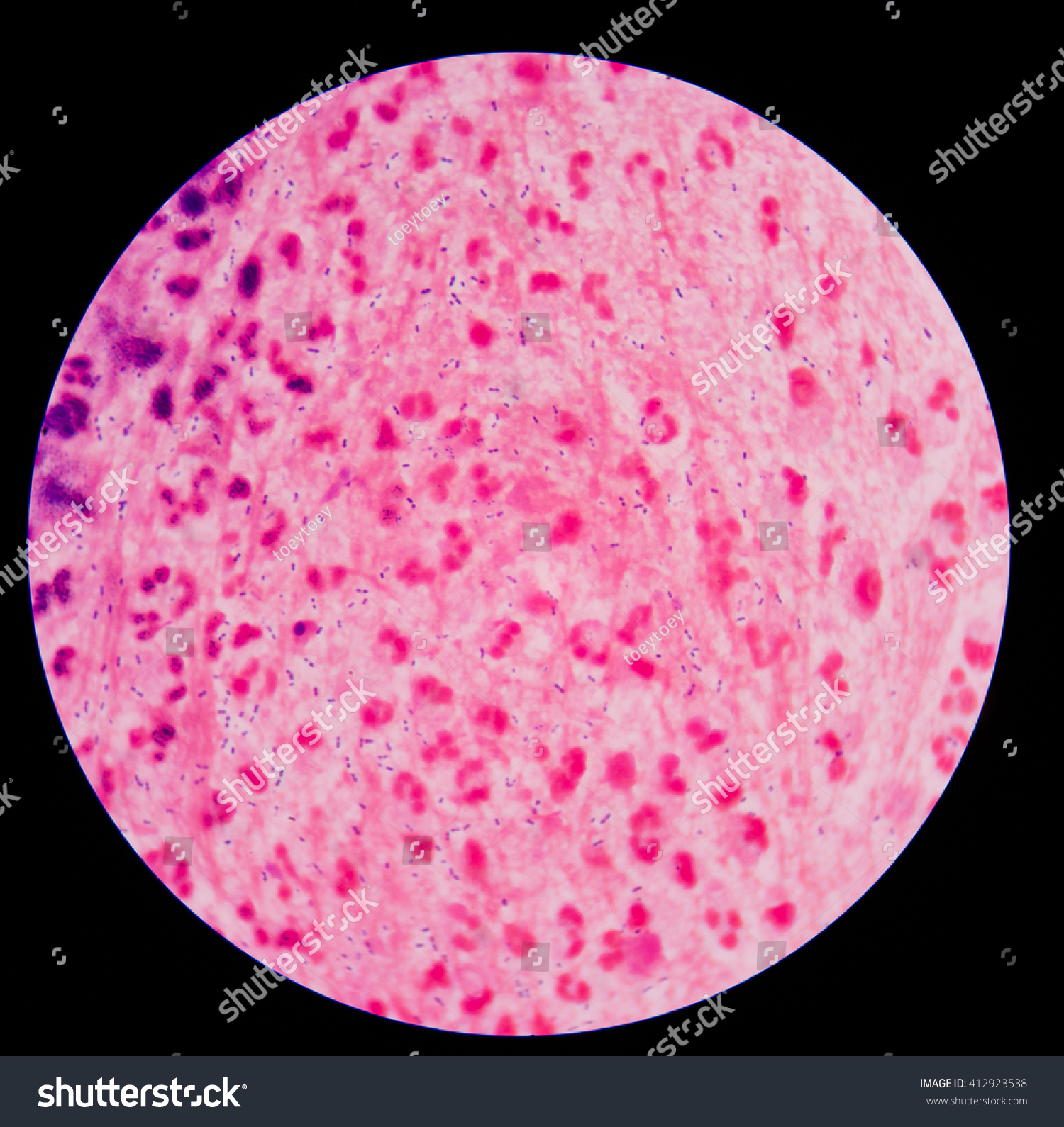 Gram Staining Called Grams Method Method Stock Photo