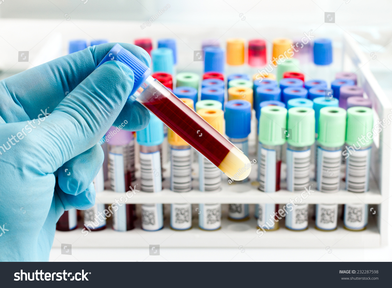 Hand Lab Technician Holding Blood Tube Stock Photo 232287598 Shutterstock