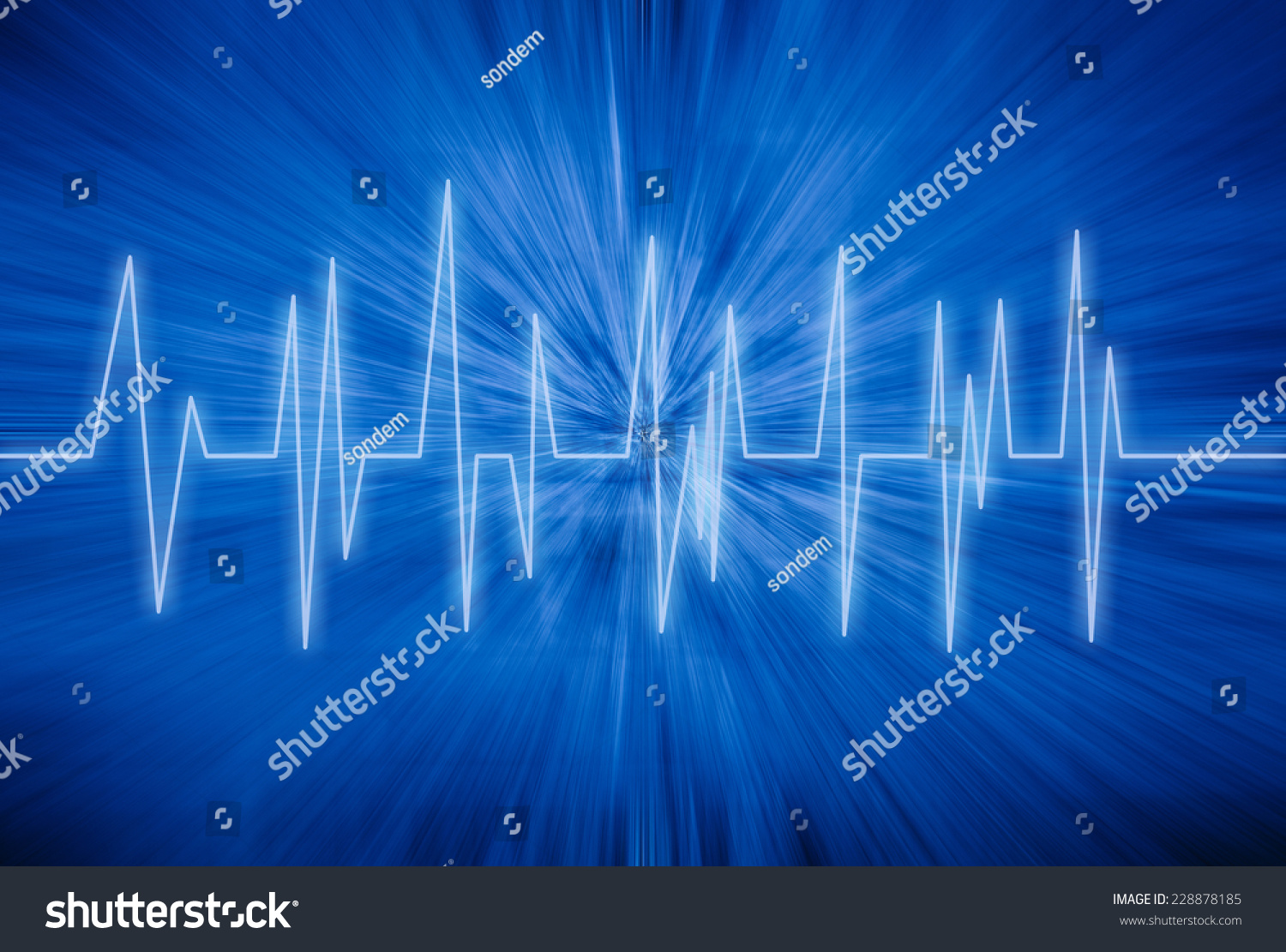 heart-rhythm-stock-photo-228878185-shutterstock