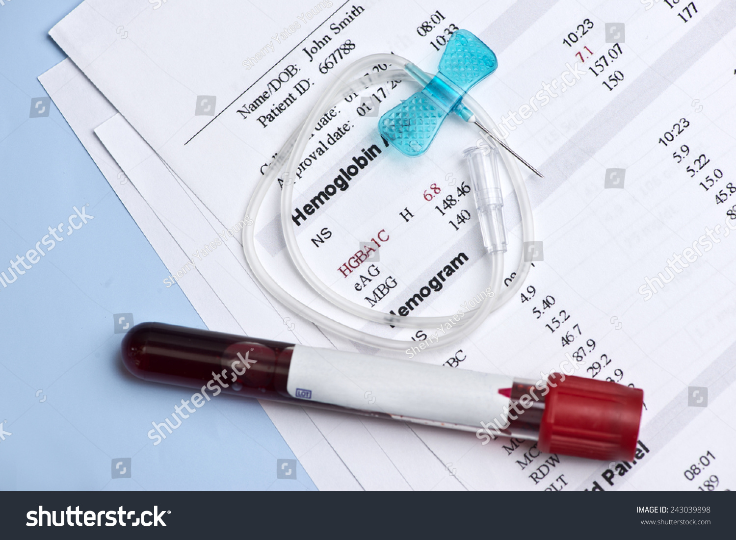 Hematology A1c Report With Butterfly Catheter And Blood Collection Tube