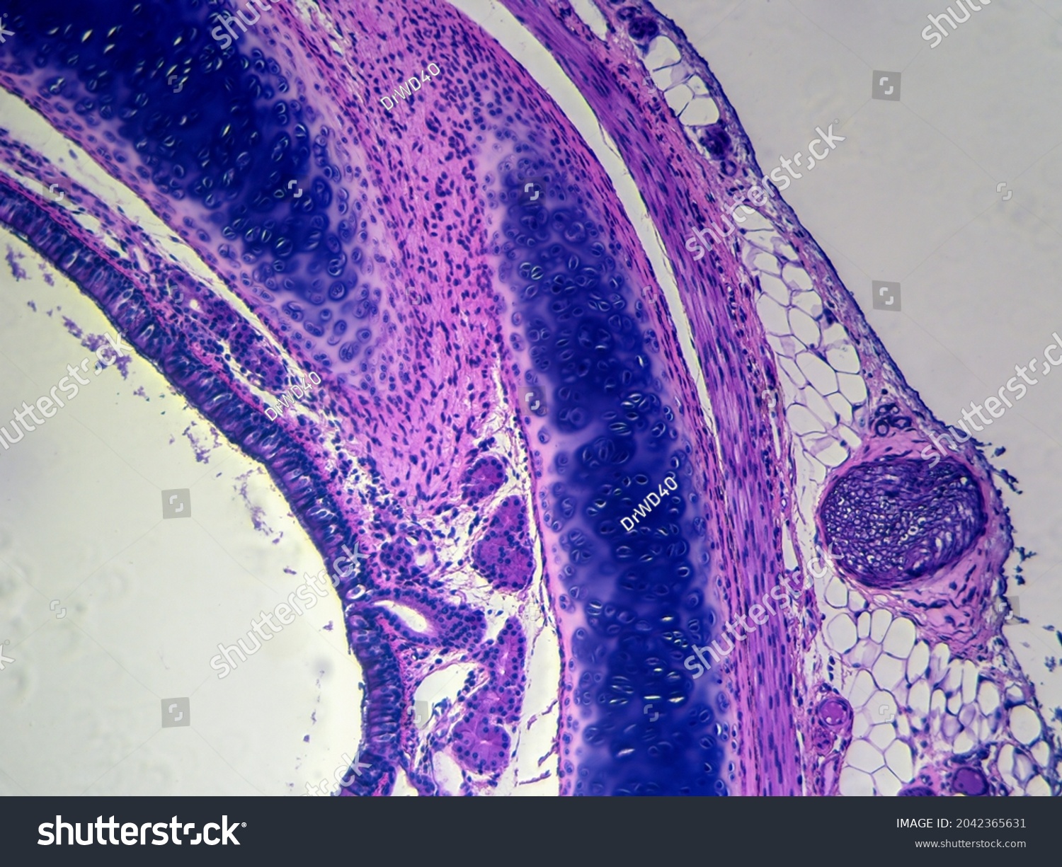 Histology Image Trachea Showing Hyaline Cartilage Stock Photo Edit Now