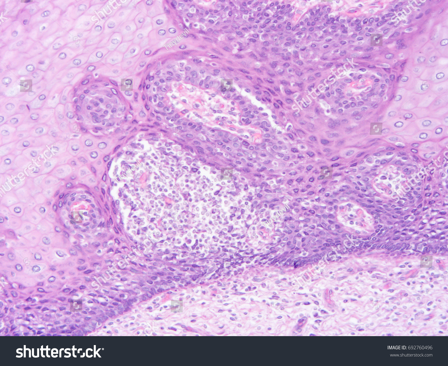 Histology Human Salivary Gland Tissue Show Stock Photo