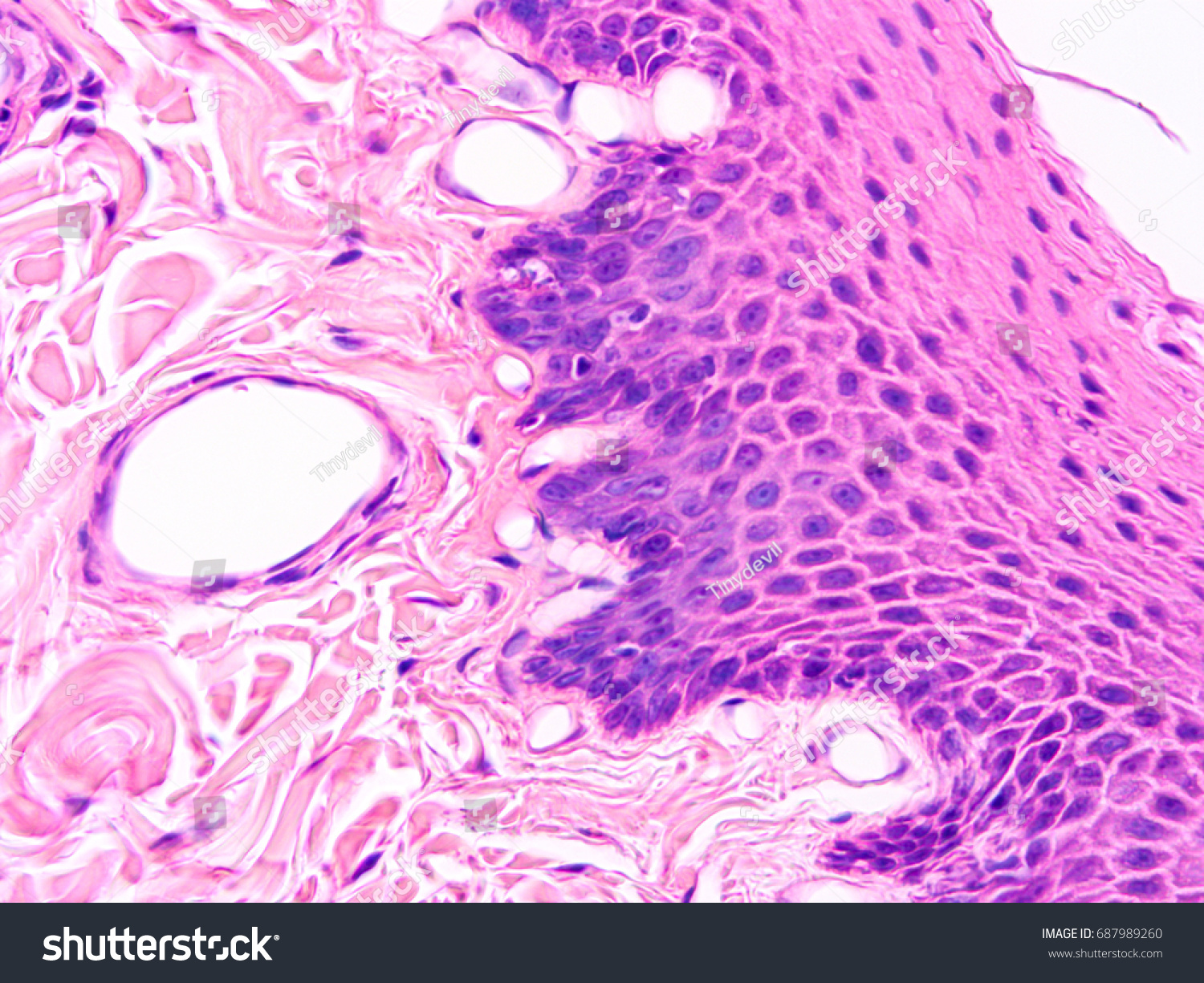 Histology Human Salivary Gland Tissue Show Stockfoto Jetzt Bearbeiten