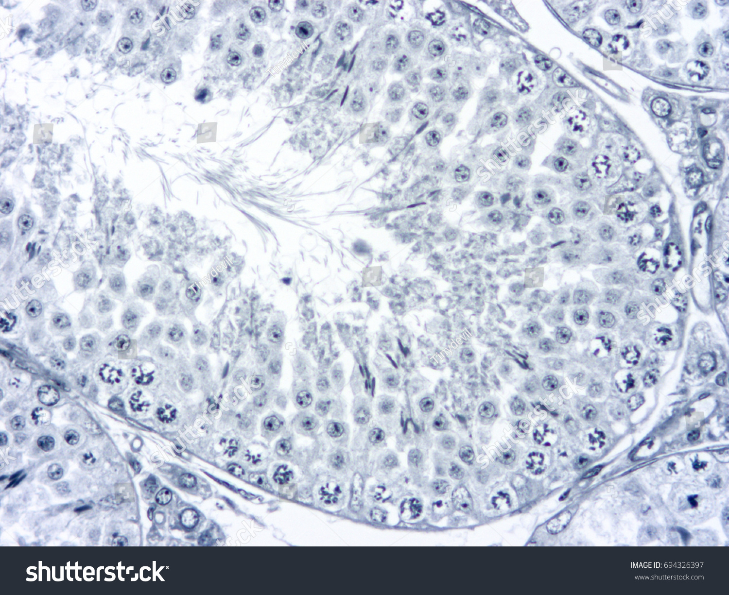 Histology Human Testis Tissue Show Spermatogenesis Foto Stok