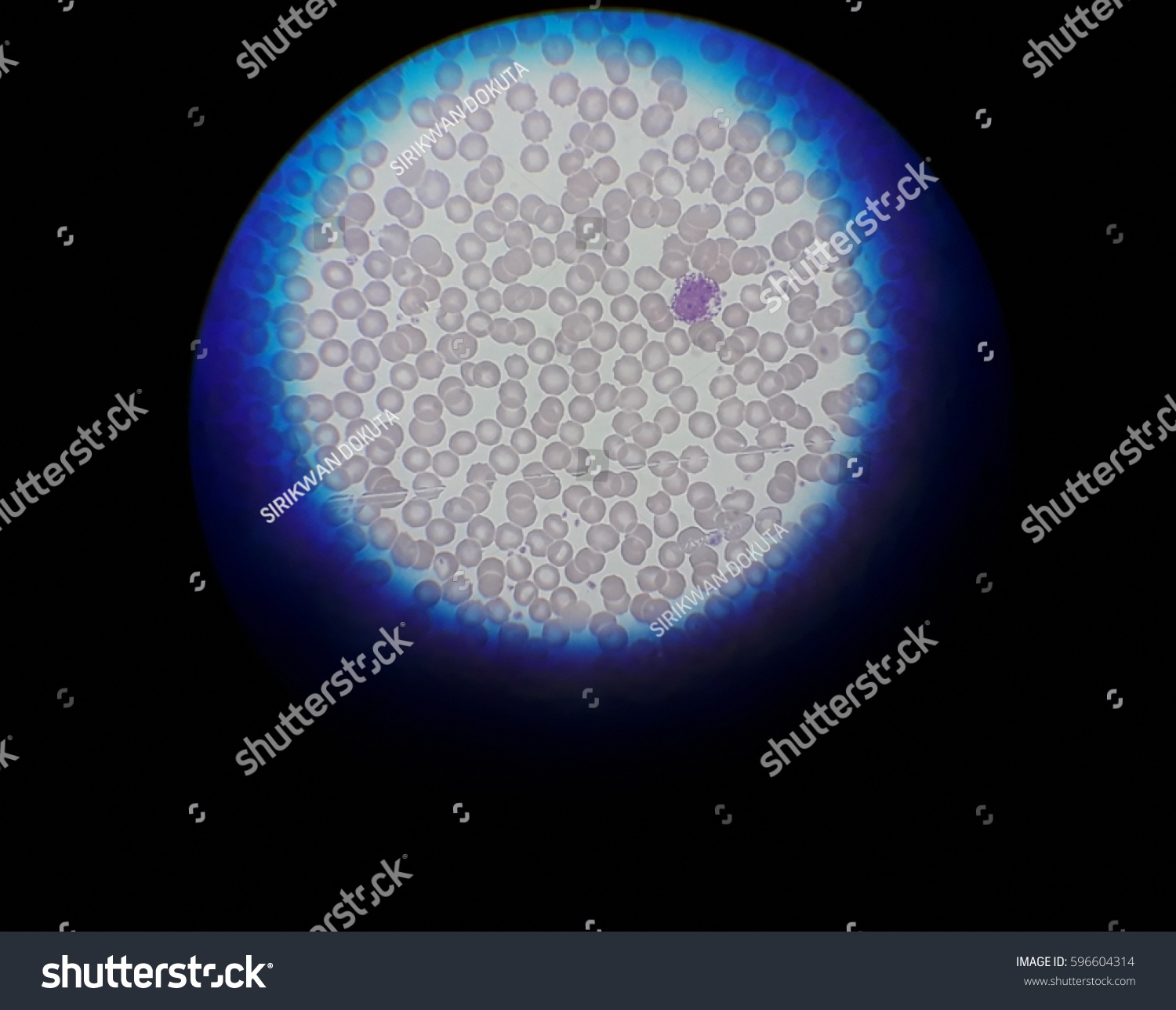 Human Blood Smear Under X Light Stock Photo Shutterstock