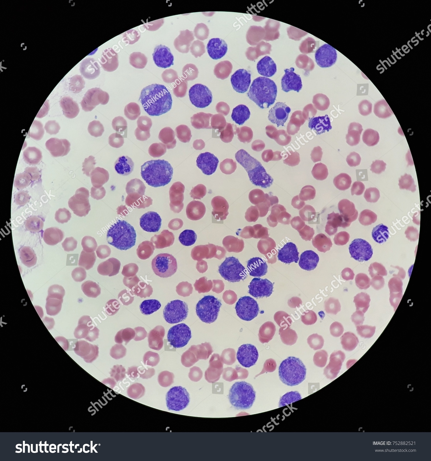 Human Blood Smear Under X Light Shutterstock