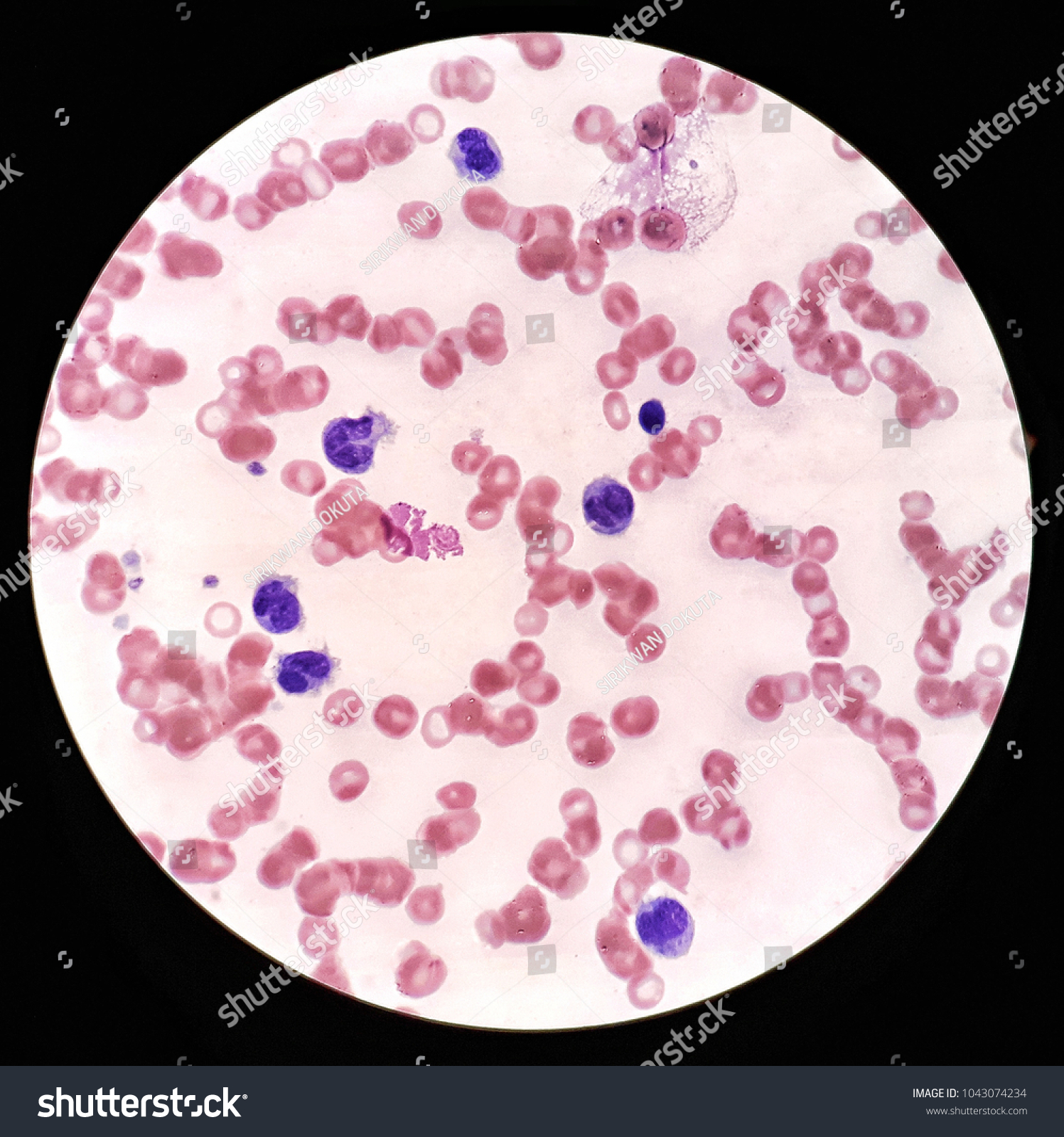 Human Blood Smear Under 100x Light Foto Stock 1043074234 Shutterstock