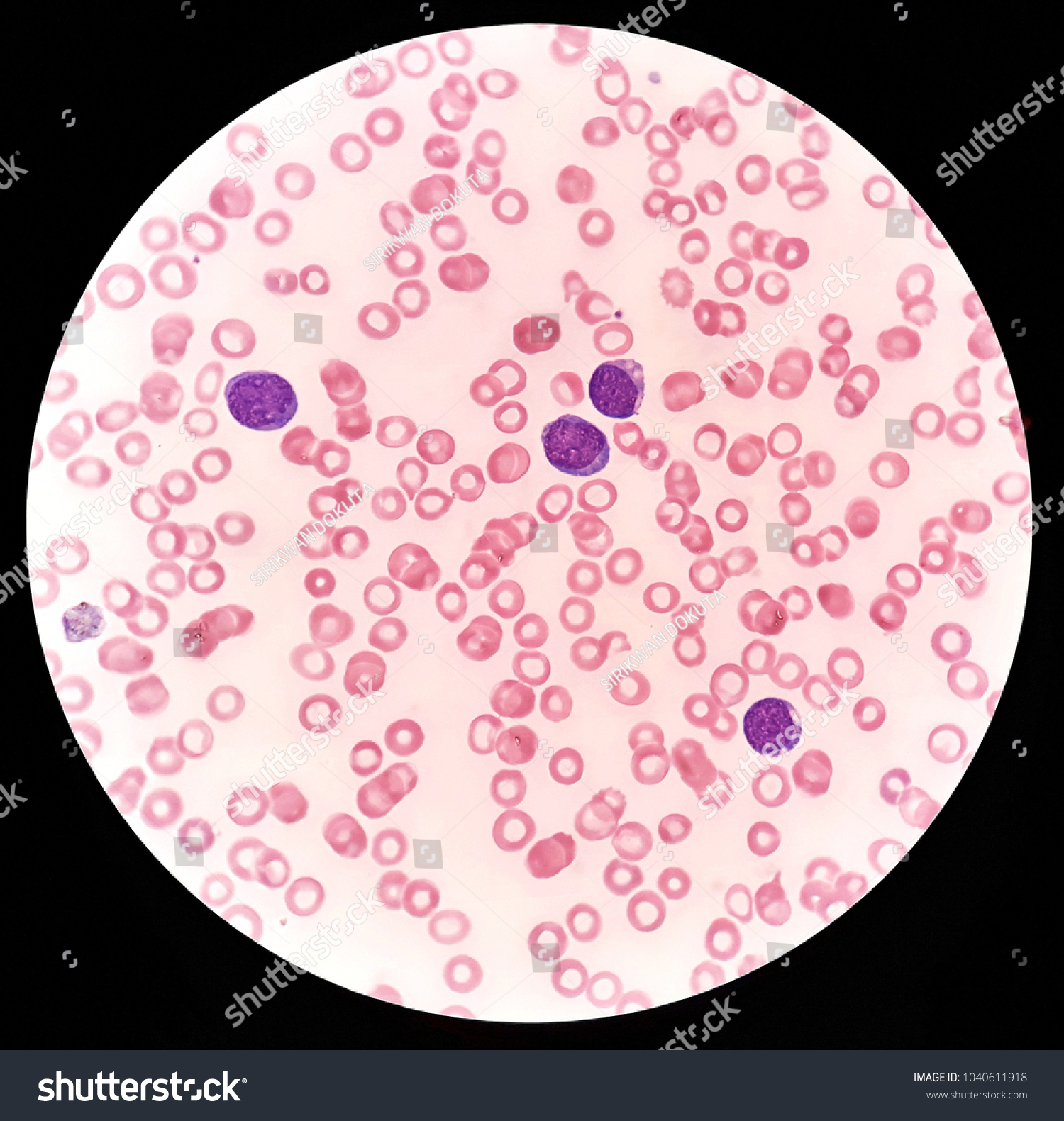 Human Blood Smear Under X Light Foto Stock Shutterstock