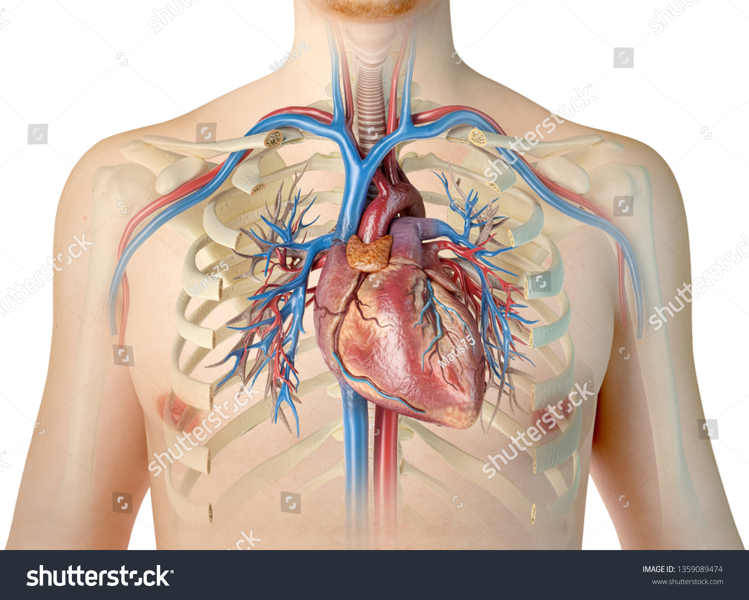 Injury To Heart Great Vessels And Bronchus Presentation