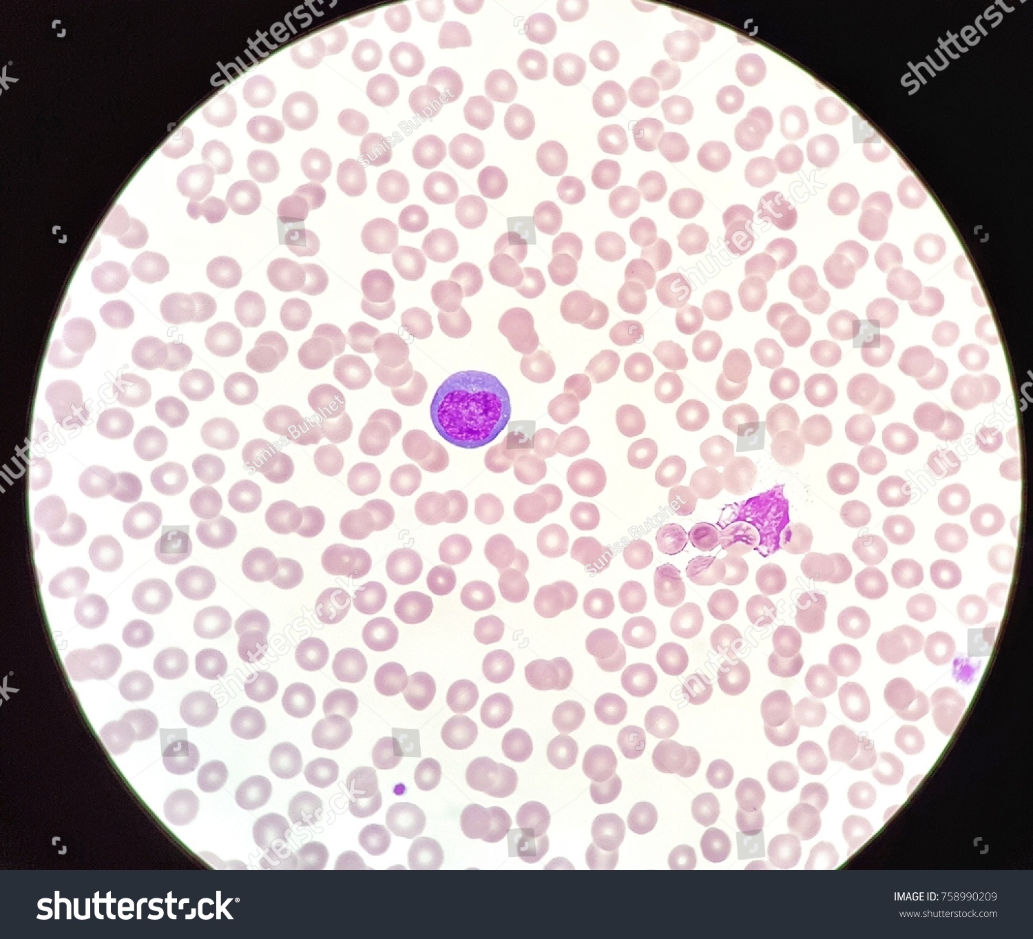 Human Peripheral Blood Smear Under X Foto De Stock