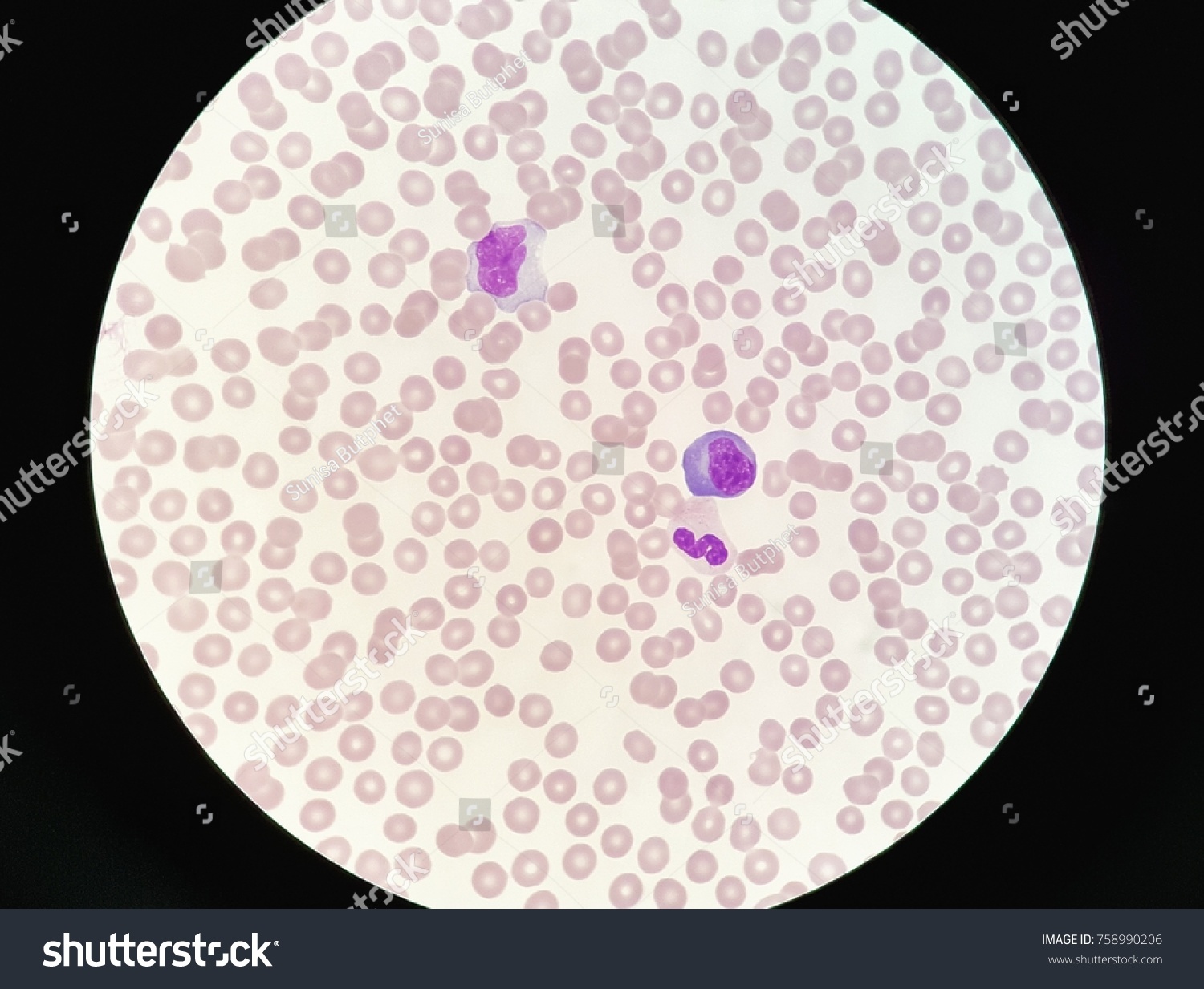 Human Peripheral Blood Smear Under 100x Stock Photo Edit Now 758990206