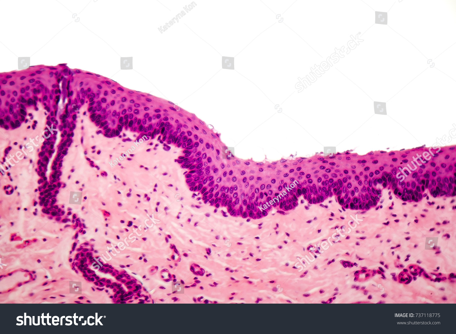 Human Stratified Squamous Epithelium Under Microscope Stock Fotografie