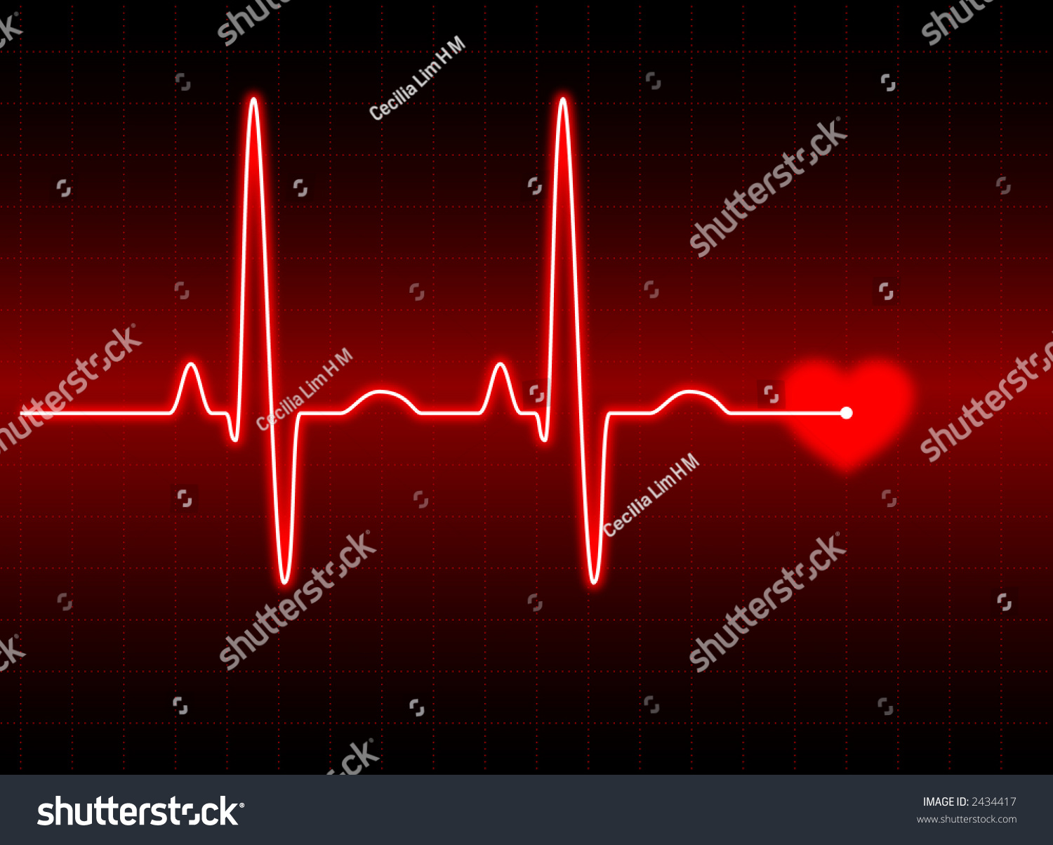 Electrocardiogram Ecg Ekg Stock Illustration Shutterstock Hot Sex Picture 5698