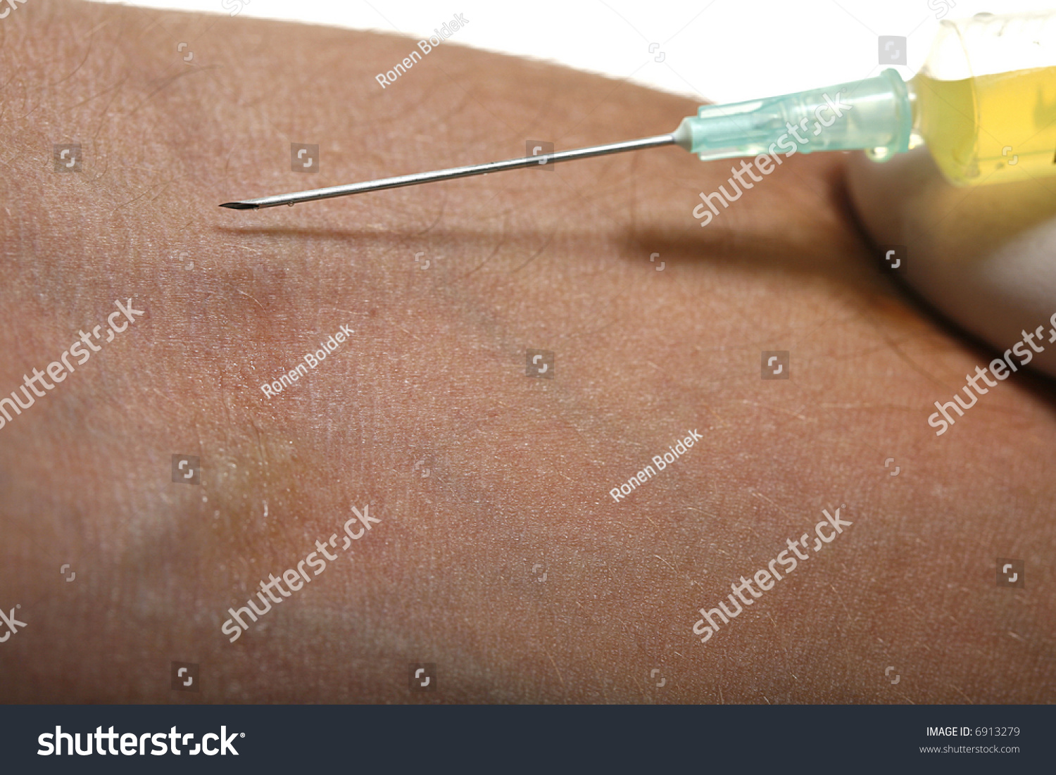 Injection Drug Vein Stock Photo Shutterstock