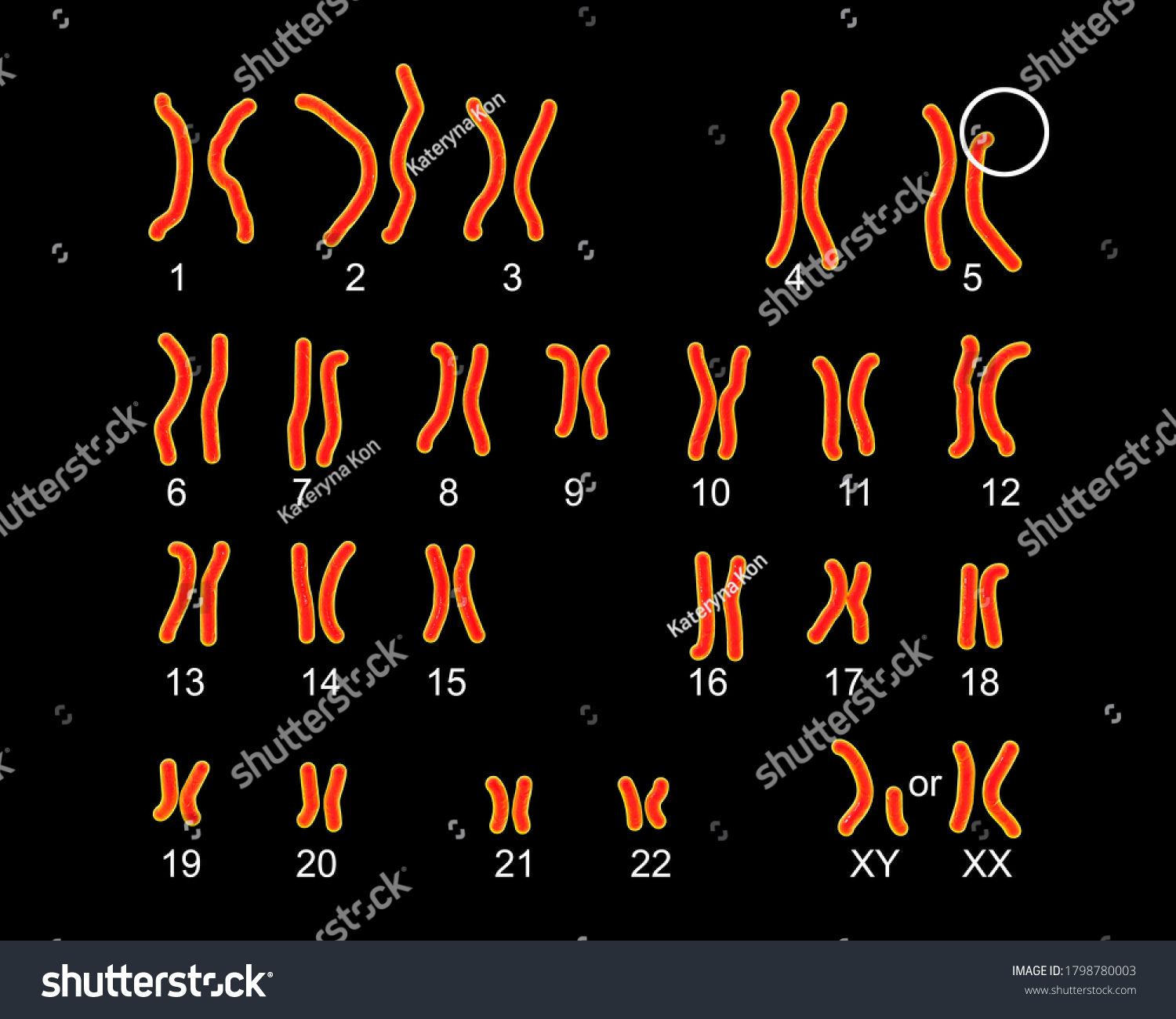 Karyotype Cri Du Chat Cats Cry Shutterstock