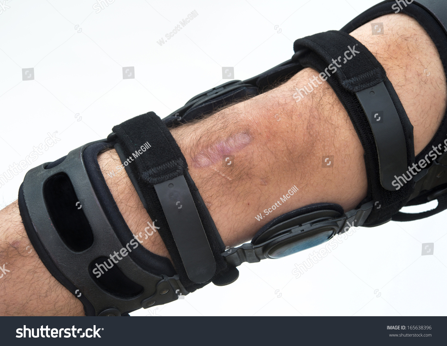 Knee Brace For Acl Football Knee Injury. Stockfoto 165638396 Shutterstock