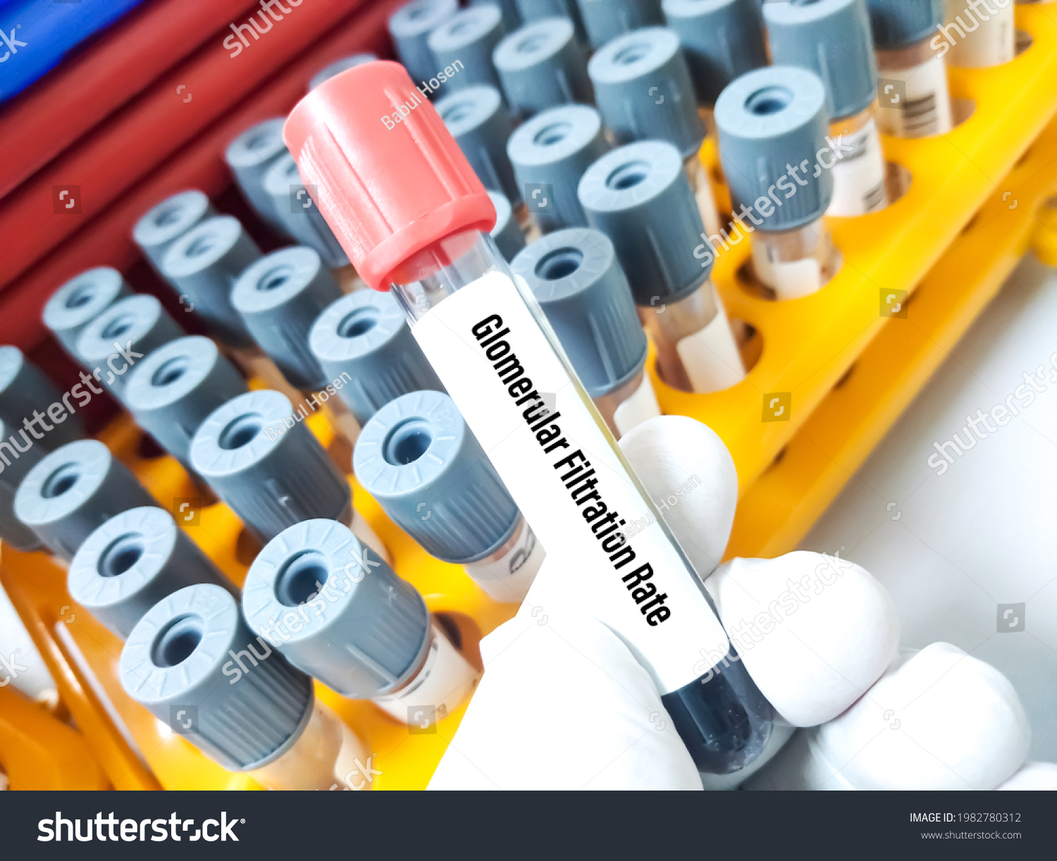 Lab Technologist Holds Blood Sample Glomerular Stock Photo