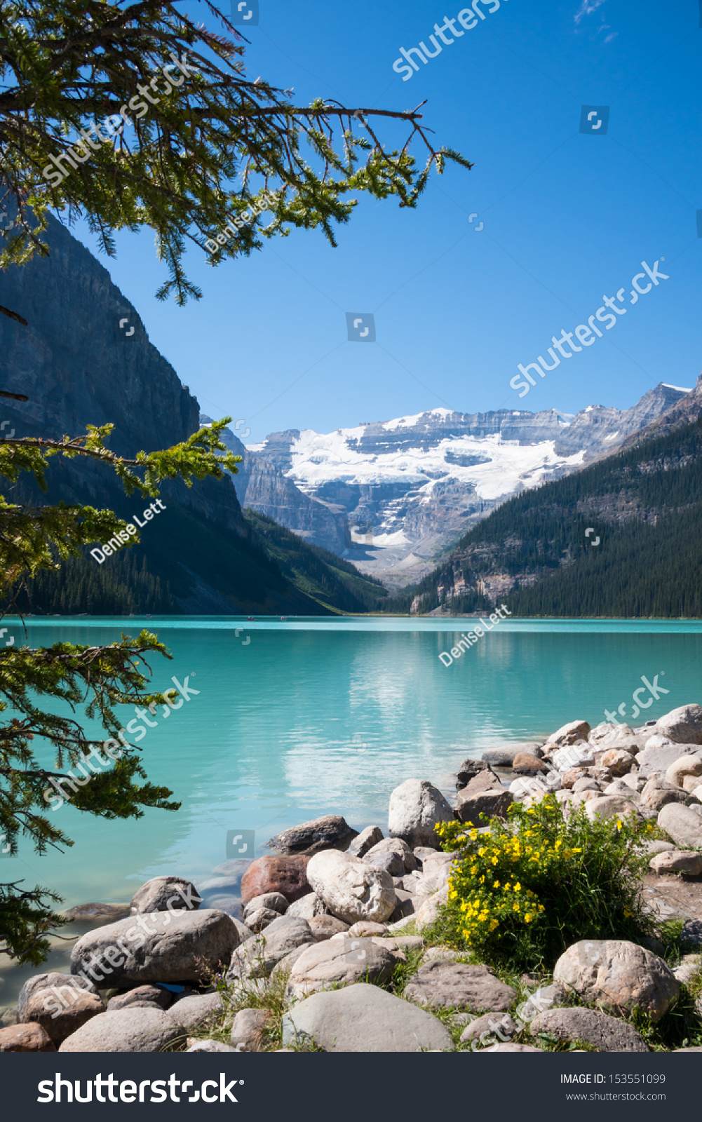 Lake Louise And Mount Victoria With Its Glacier, Alberta, Canada. Vertical. Copy Space. Stock ...