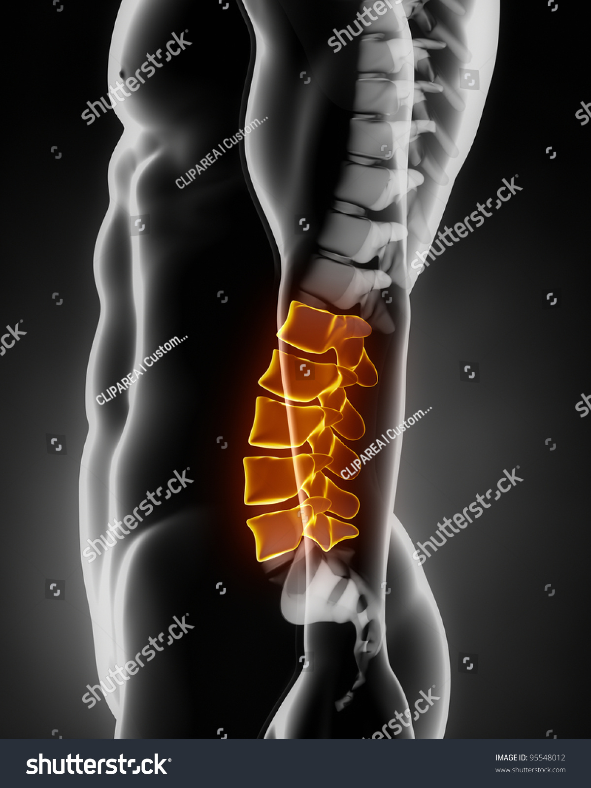 Lateral Lumbar Spine Anatomy