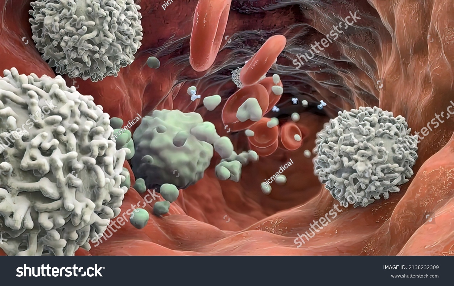 Macrophage Devouring Cancer Cell Immune Cells Stock Illustration