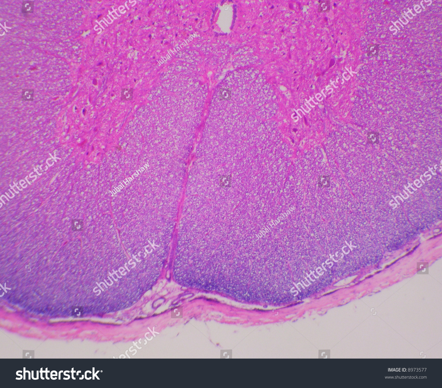 Mammalian Spinal Cord--Portion Of A Cross Section Stock Photo 8973577