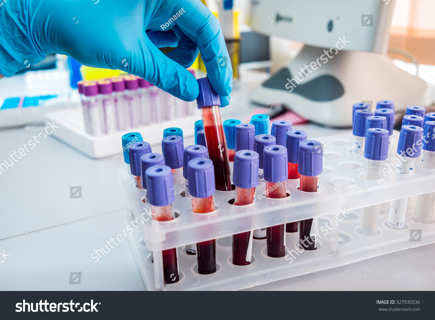 Medical Equipment Blood Test Stock Photo 327930536 Shutterstock