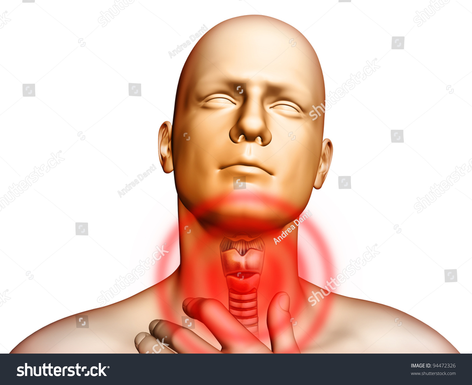 Medical Illustration Showing Pain Located In The Throat Area Digital 