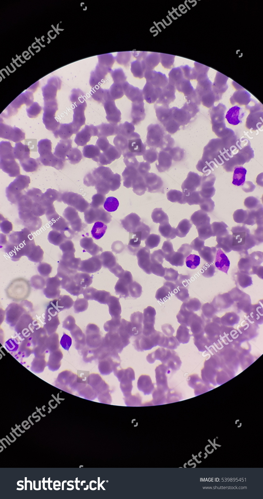 Mixed shape of white blood cell Mixed shape of white blood cell