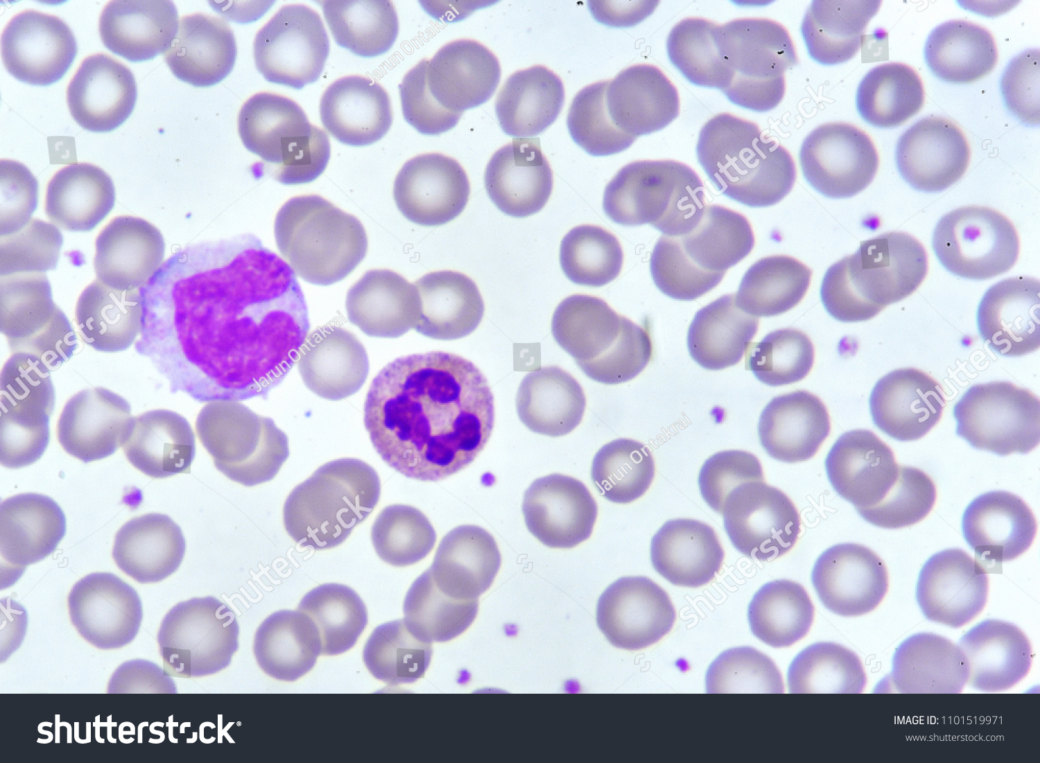 Monocyte Neutrophil Cell Blood Smear Analyze Stock Photo Edit Now