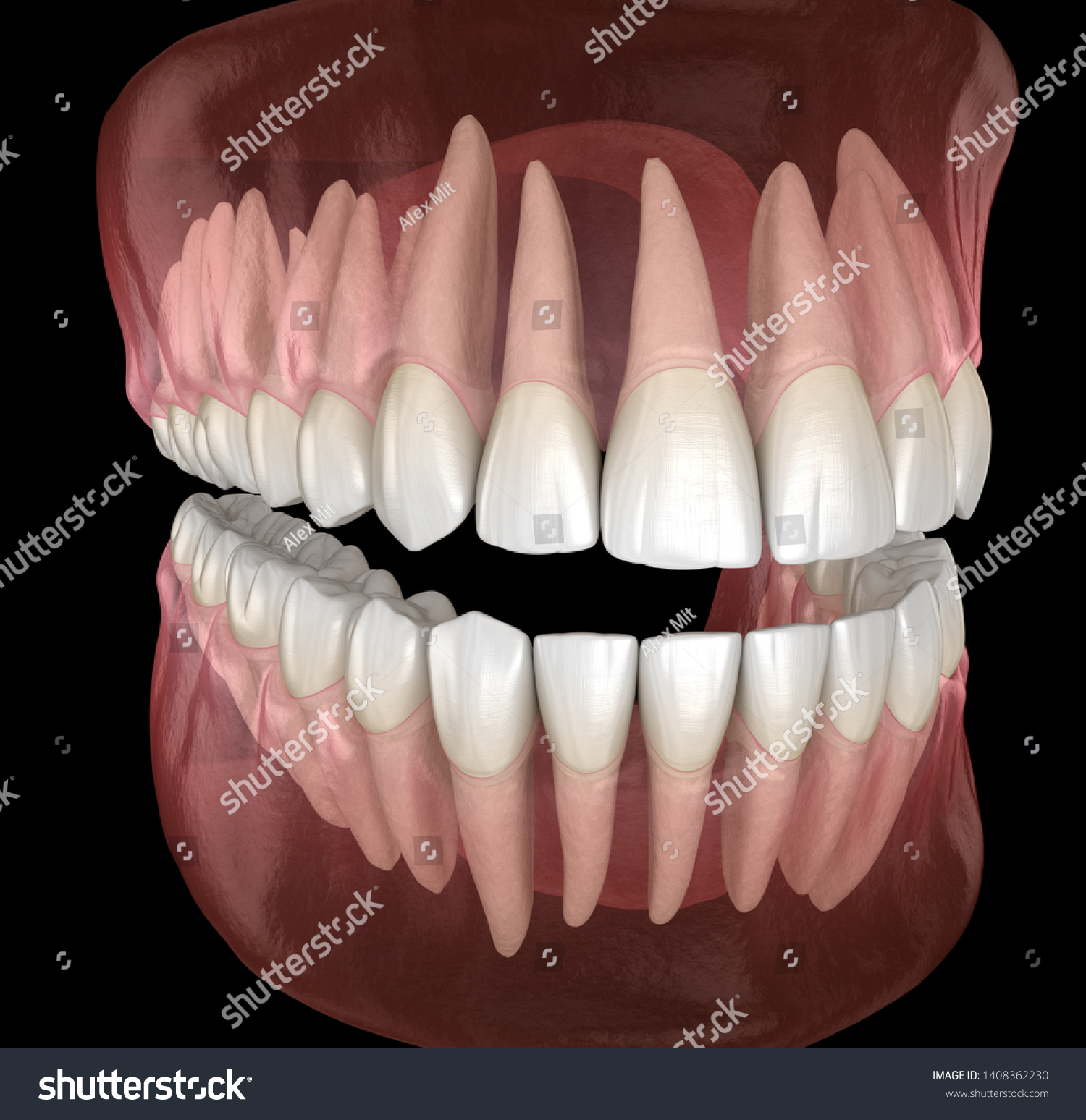 Ilustrasi Stok Morphology Mandibular Maxillary Human Gum Teeth