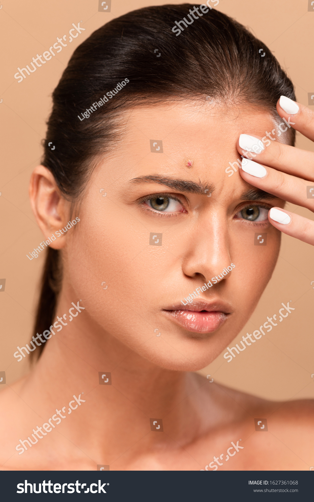 Naked Woman Pimple On Face Touching Shutterstock