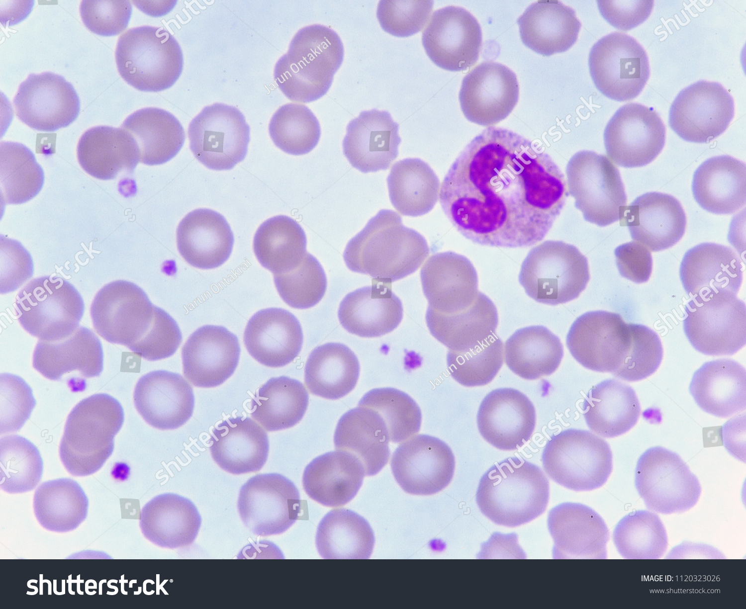 Neutrophil Cell Blood Smear Analyze By Stock Photo Edit Now