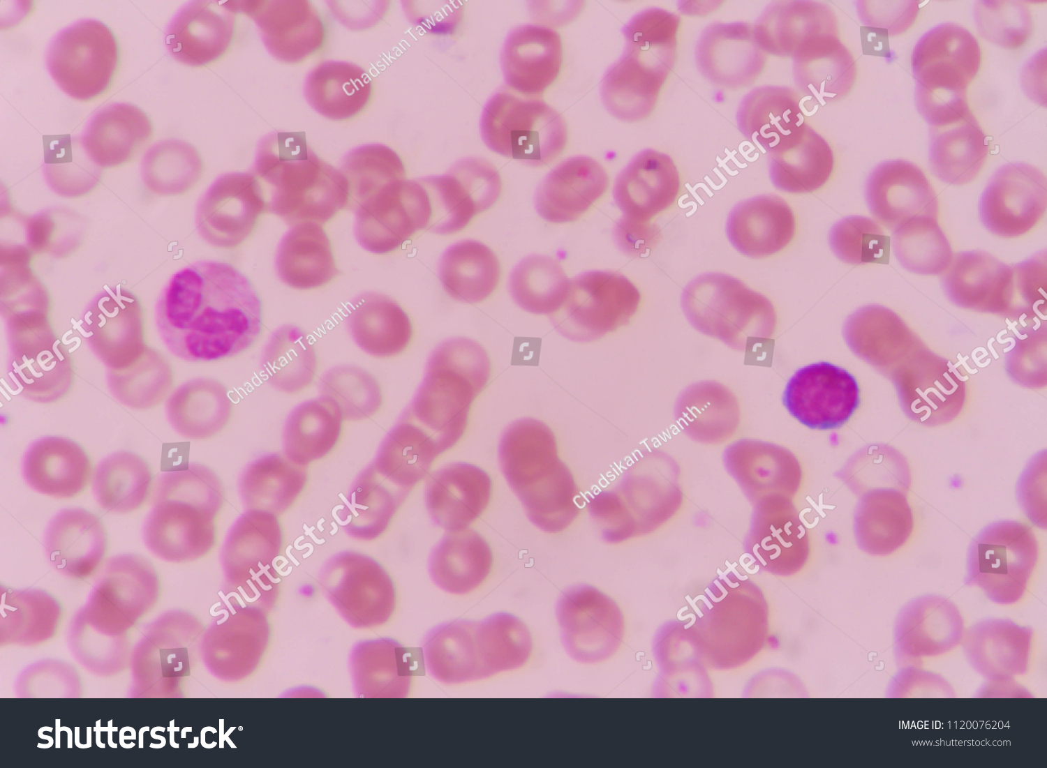 Neutrophil Lymphocyte Blood Smear Under Microscopy Stock Photo Edit