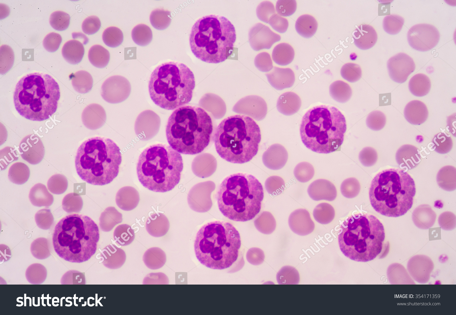 neutrophils-blood-smear-is-often-used-as-a-follow-up-test-to-abnormal