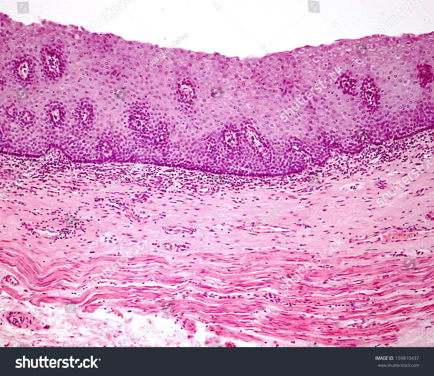 non-keratinized-stratified-squamous-epithelium-of-the-human-esophagous