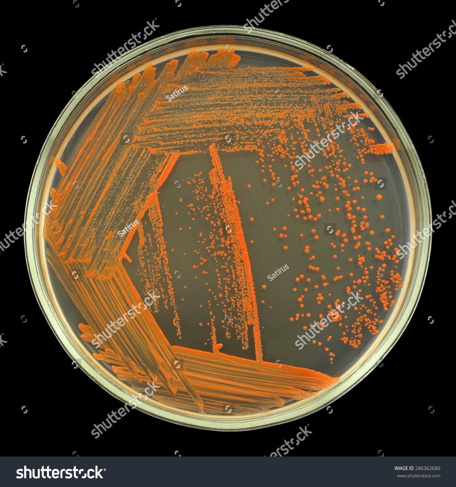 Orange Bacterial Colonies On A Petri Dish (Agar Plate) Isolated On A ...