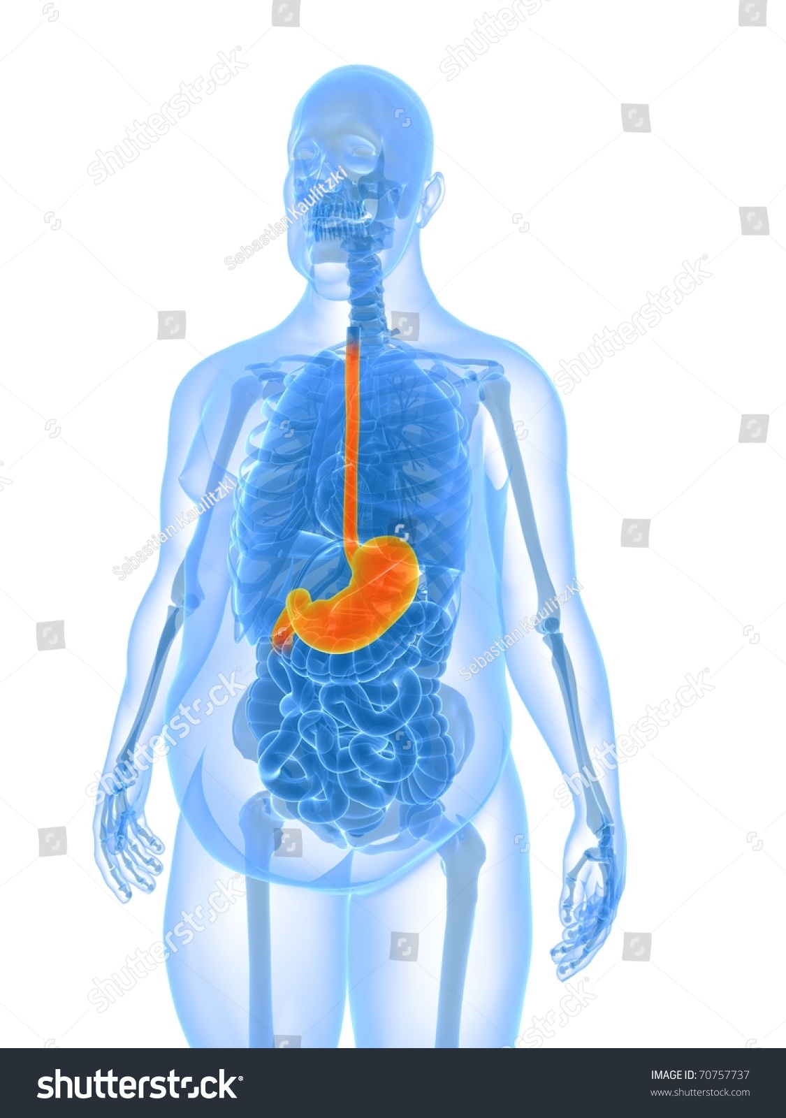 Overweight Male Anatomy - Stomach Stock Photo 70757737 : Shutterstock