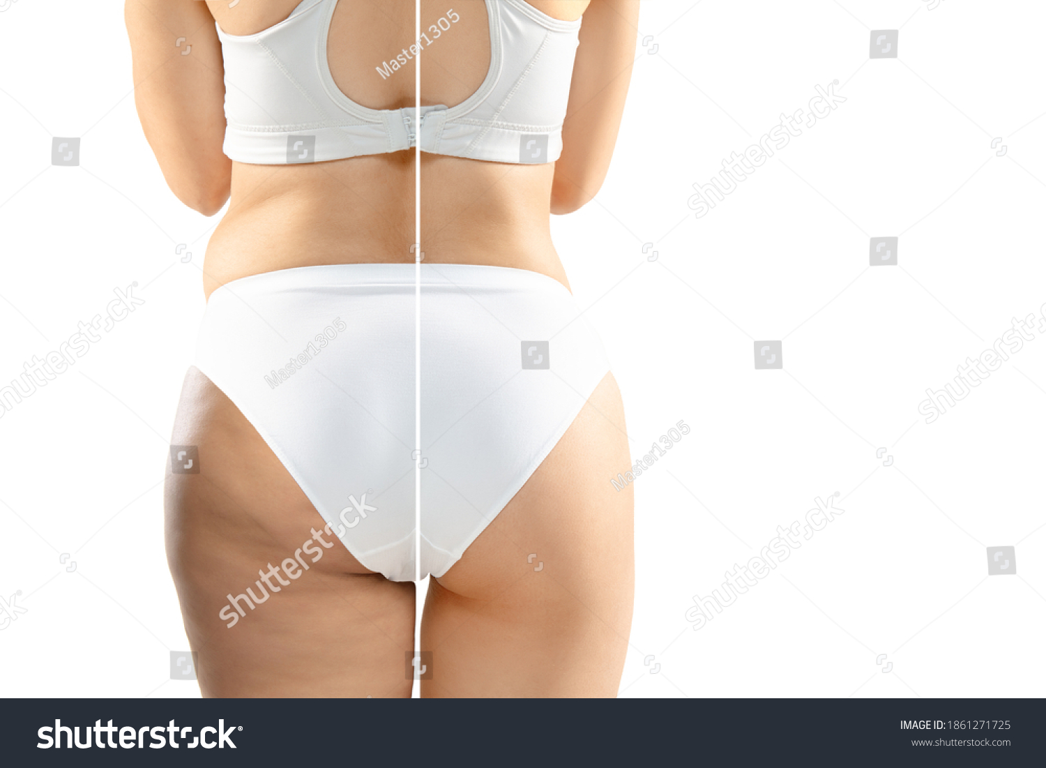 Overweight Woman Cellulite Legs Buttocks White Stock Photo 1861271725