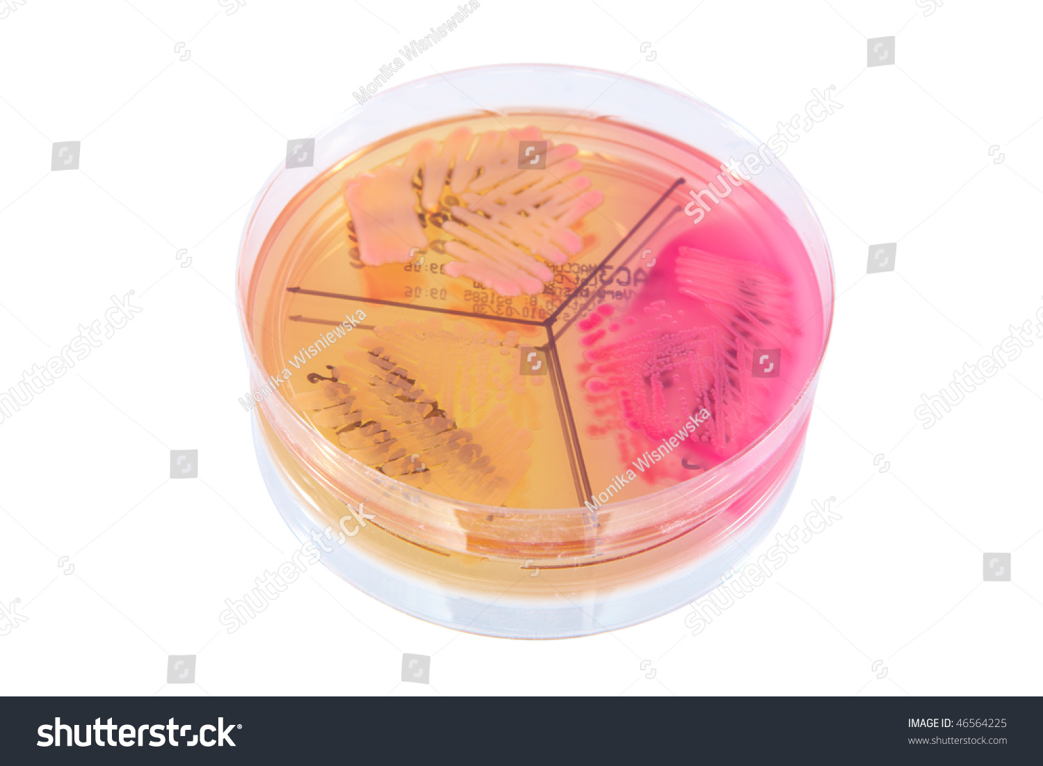 examination of bacterial plates Microscopic examination and bacterial culture of bile samples are common during diagnostic work-up of hepatobiliary disease in small animals1-4 aerobic and anaerobic culture plates had been ex-amined for bacterial growth frequency for up to 5 days. examination of bacterial plates Microscopic examination and bacterial culture of bile samples are common during diagnostic work-up of hepatobiliary disease in small animals1-4 aerobic and anaerobic culture plates had been ex-amined for bacterial growth frequency for up to 5 days.
