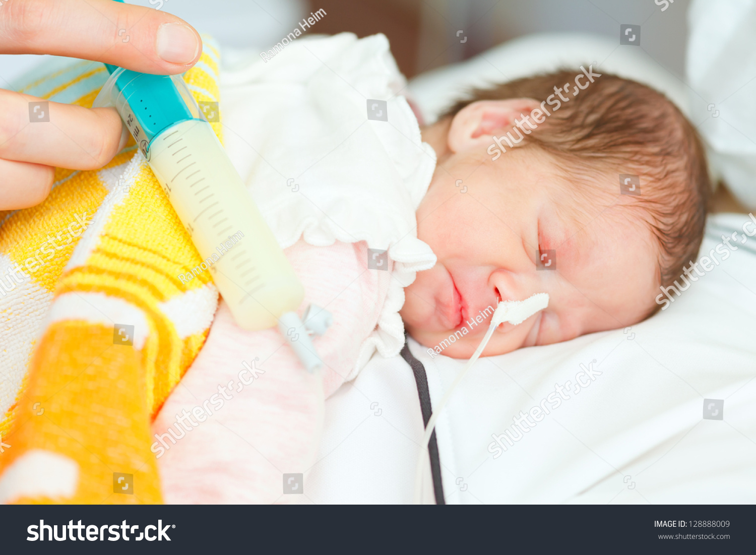 Premature Infant Gets Total Parenteral Nutrition Stock Photo 128888009 ...