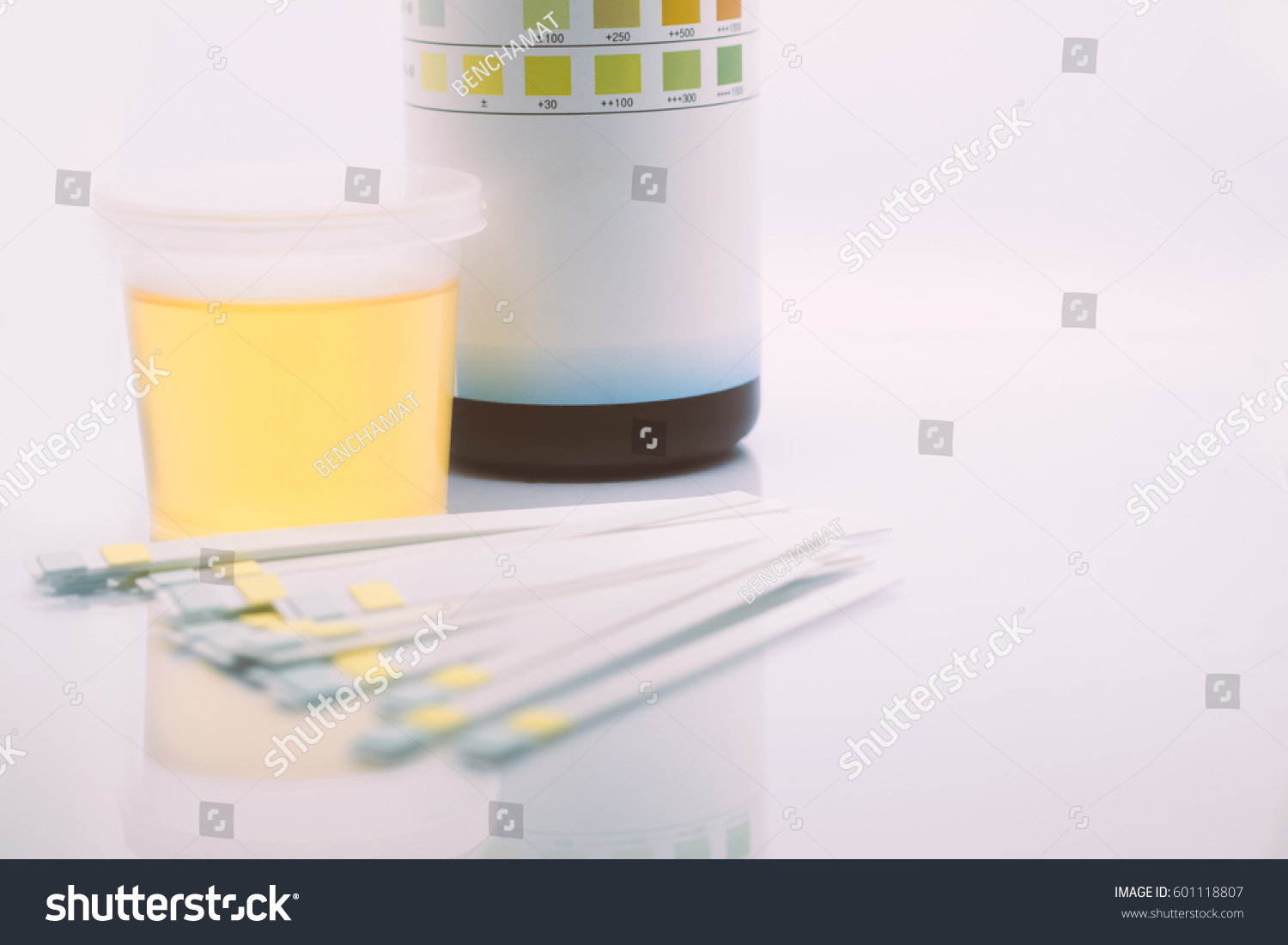 Reagent Strip Urinalysis Routine Urinalysis Checkup Stock Photo Edit