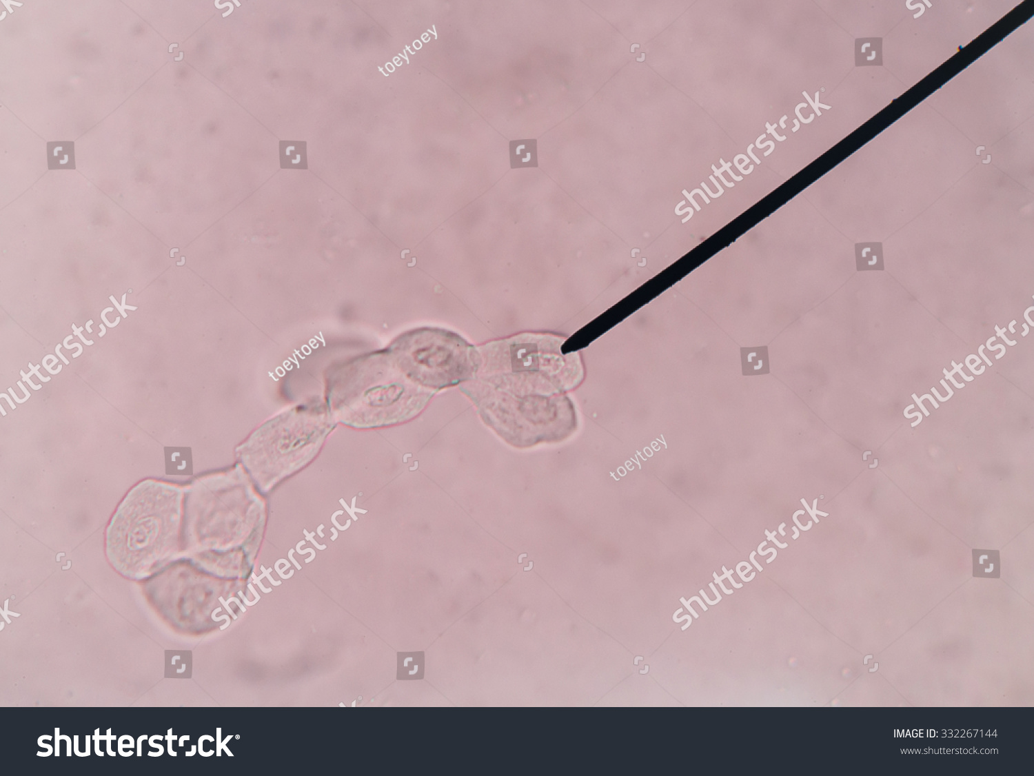 Renal Epithelial Cells Stock Photo 332267144 : Shutterstock