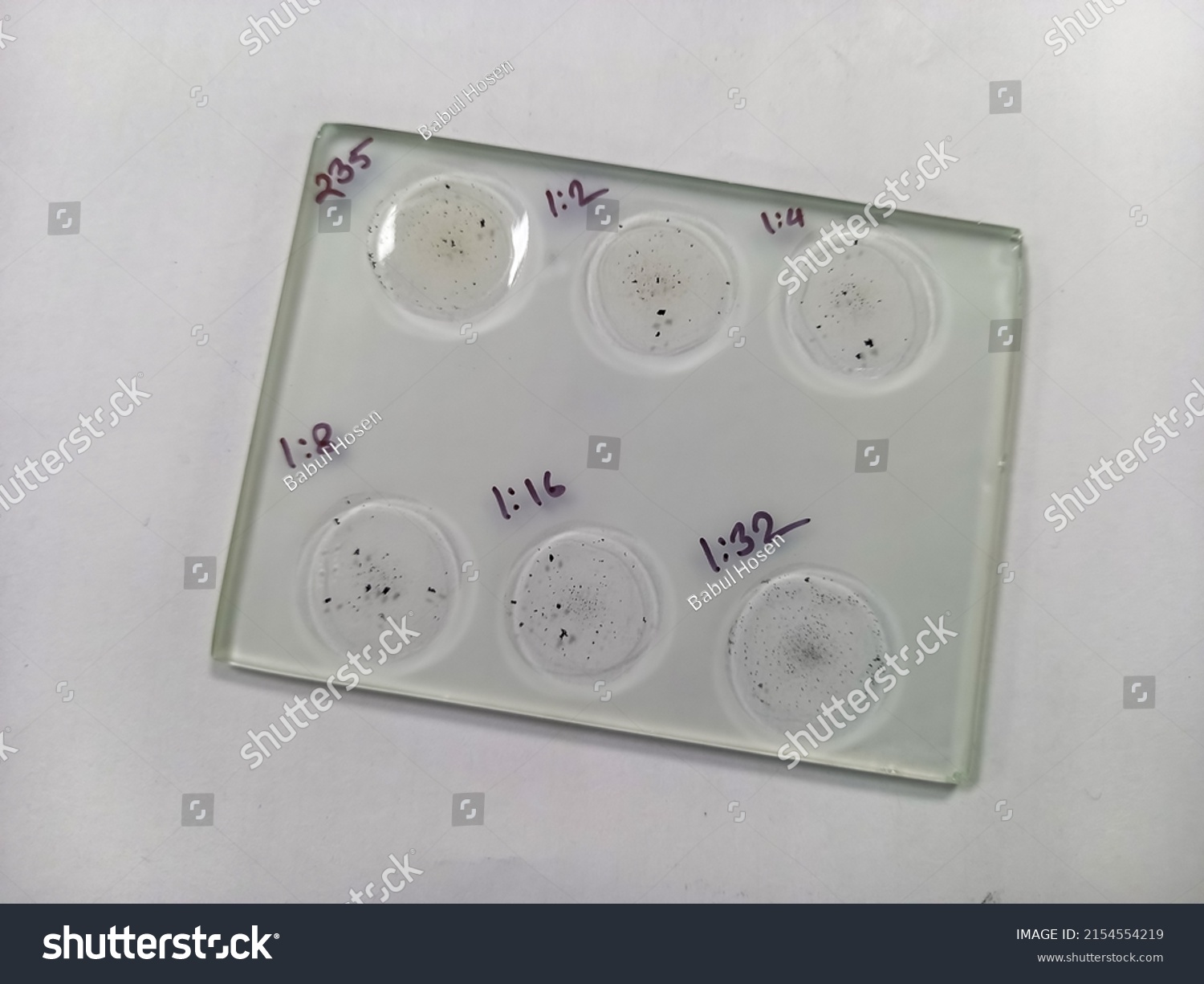 Rpr Vdrl Syphilis Test Glass Slide Stock Photo Shutterstock