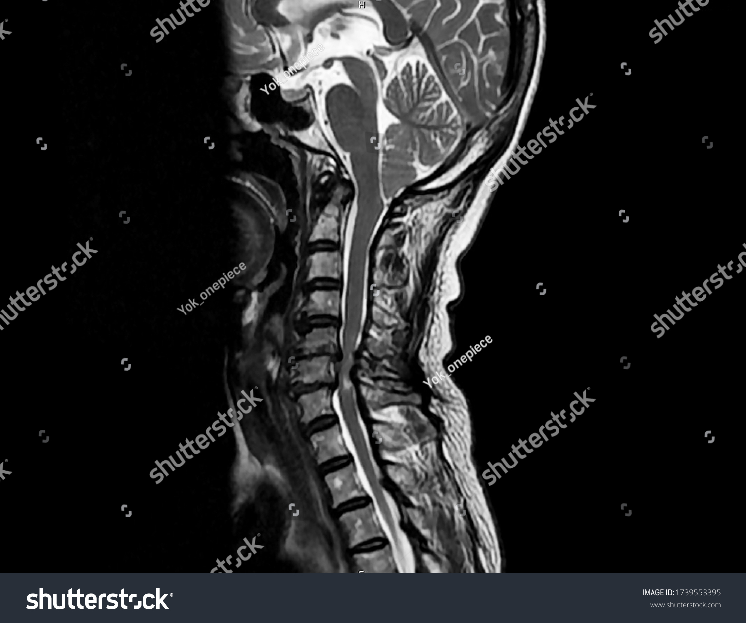 Sagittal View Magnetic Resonance Image Mri Stock Photo Edit Now