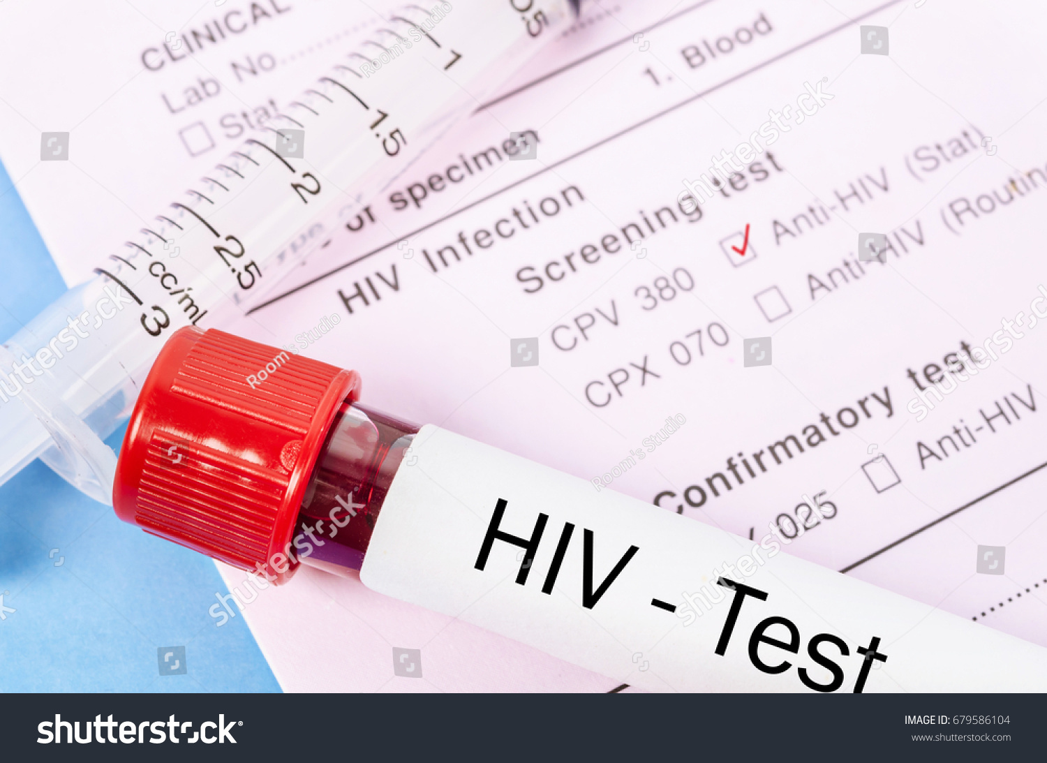 Sample Blood Collection Tube Hiv Test Stock Photo Edit Now 679586104